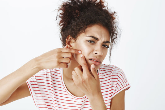 The Ultimate Skincare Routine for Acne-Prone Skin: Get Your Glow On!